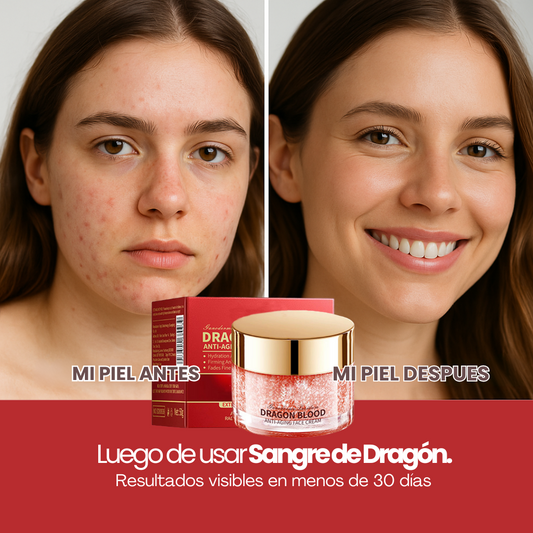 CREMA SANGRE DE DRAGÓN + SERUM SANGRE DE DRAGÓN